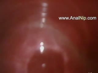 Sweet jap anal hairy sex clip